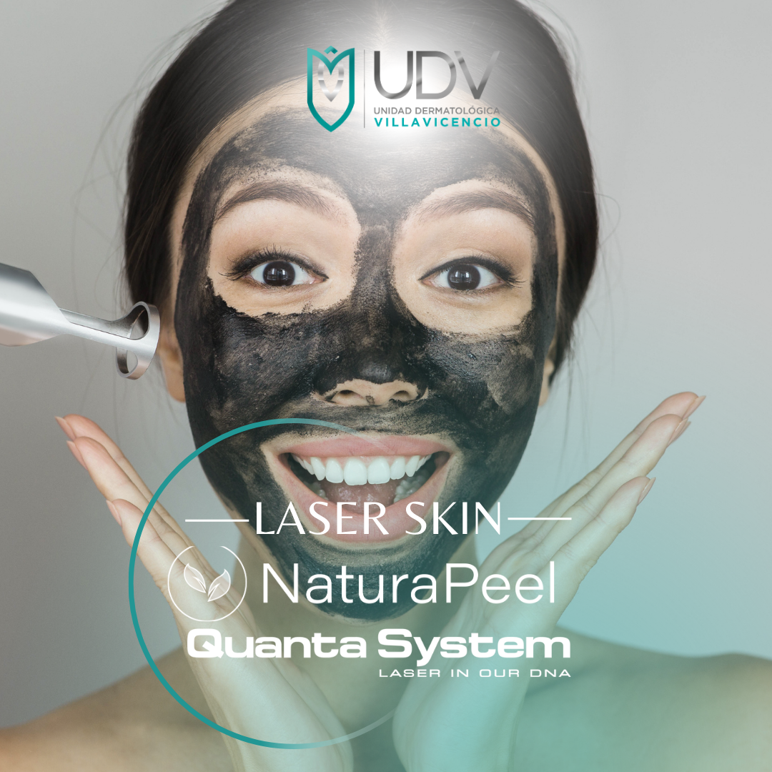 Natura Peel (Hollywood Peel) – Unidad Dermatológica Villavicencio
